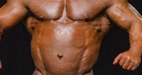 HGH Bubble Gut: Abdominal Distension in .